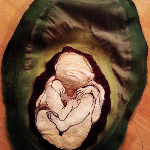 Foetus in an Avocado